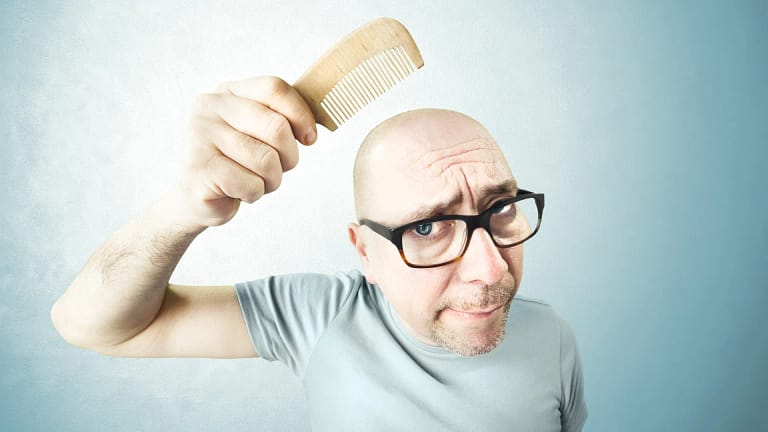 Hoje é Dia do Careca! “Ainda existe uma pressão estética muito forte”