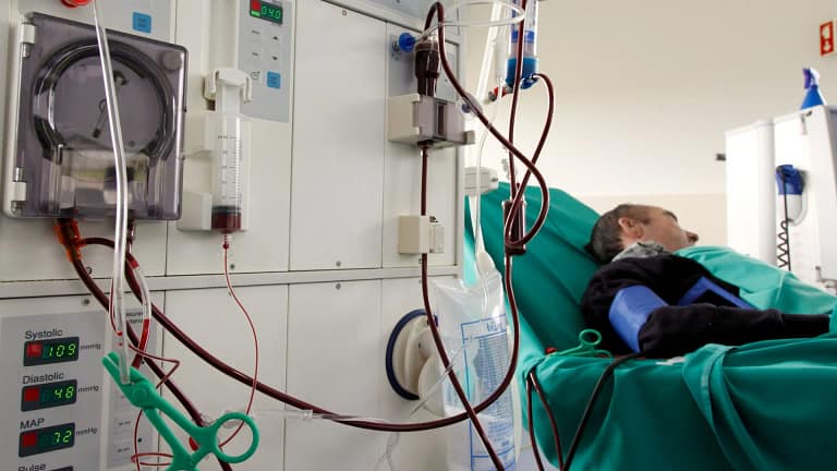 Doses personalizadas de hemodiálise aumentam sobrevivência dos doentes