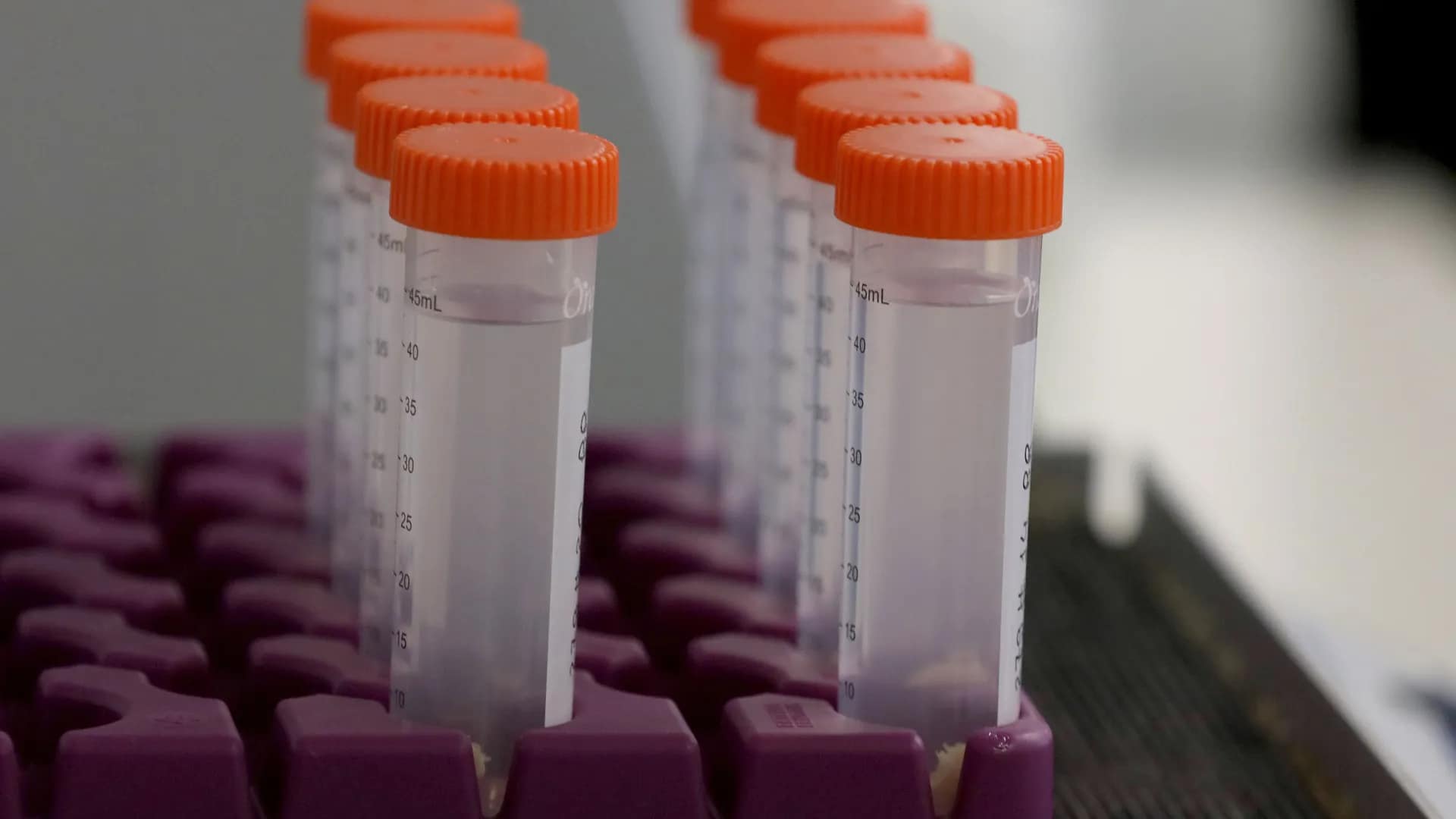 Estudo revela que reposição de vitamina C no cérebro atrasa Alzheimer Estudo revela que reposição de vitamina C no cérebro atrasa Alzheimer